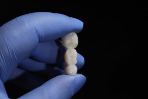 common dental bridge issues and how to fix them